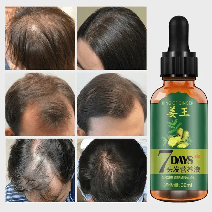 King Of Ginger Hair Growth Serum Germinal Oil - 30ml