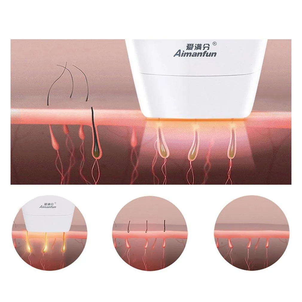 Laser Hair Removal