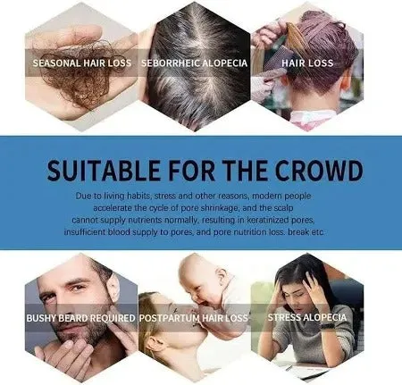 Minoxi Roll-On Hair Treatment Hair Growth Serum