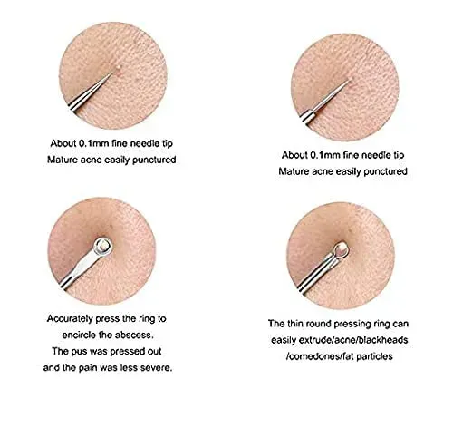 Miss Beauty New Stainless Steel Blackhead Remover Pin