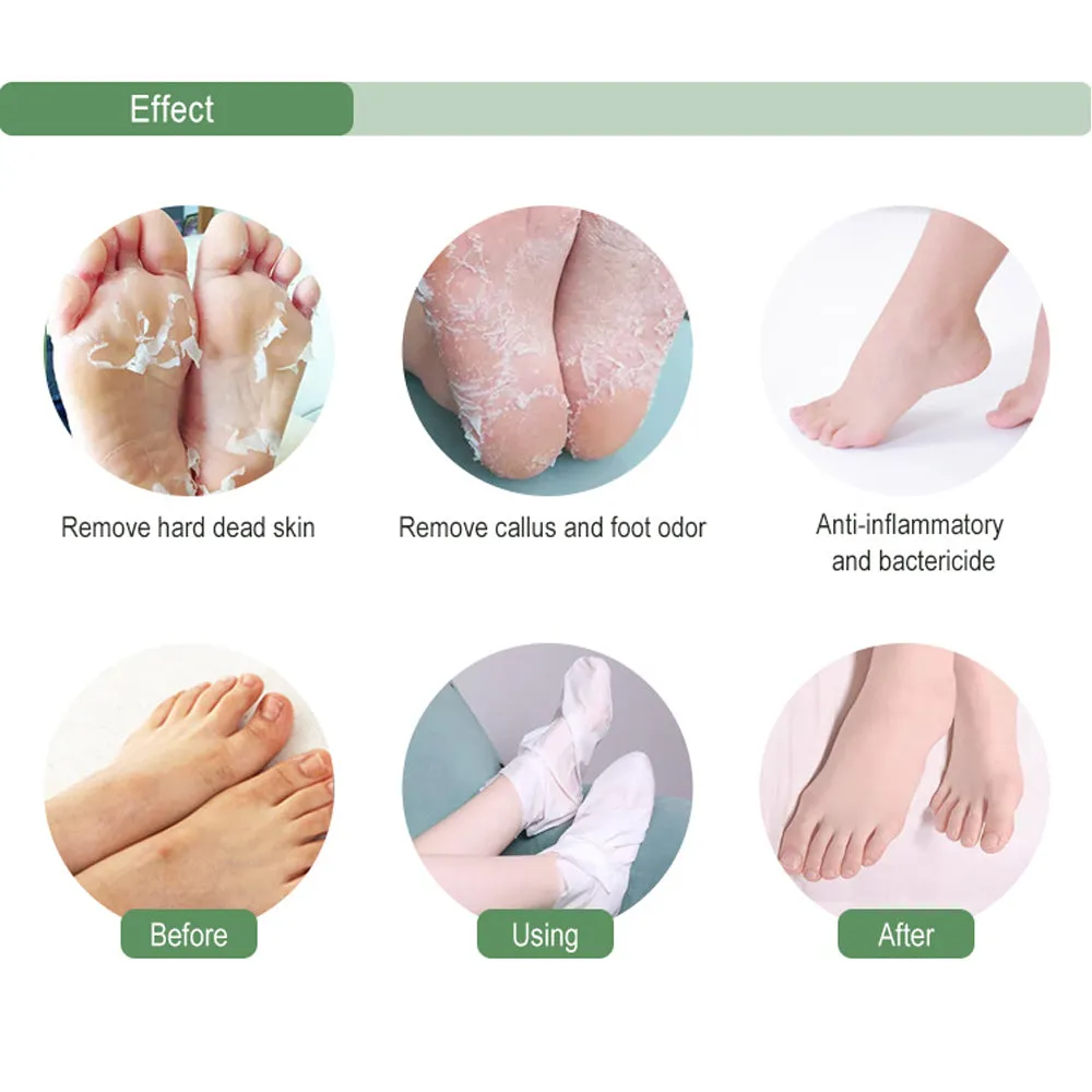 MOND'SUB  4PIECES Tea Tree Peel Foot Mask, Exfoliating, Removing Dead Skin, Moisturizing Heels, Rich In Tea Tree Essence, Pure Natural Extract.