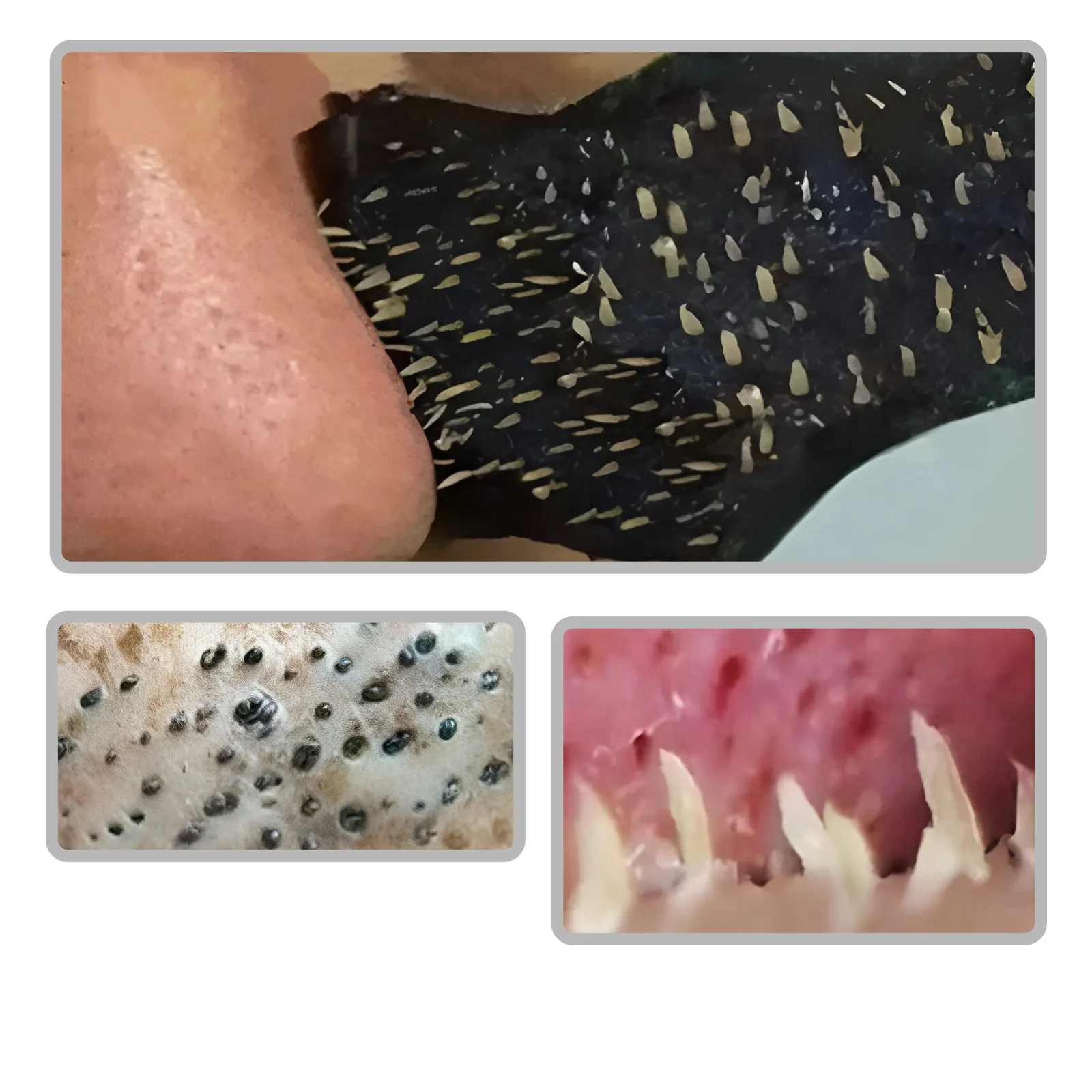 Nasal Blackhead Strips - Remover