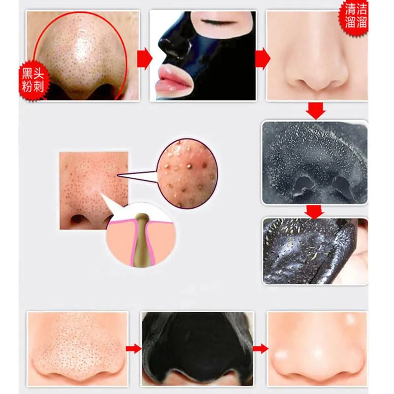 Nose Blackhead Remover Pore Strip Cleanser 10 pack
