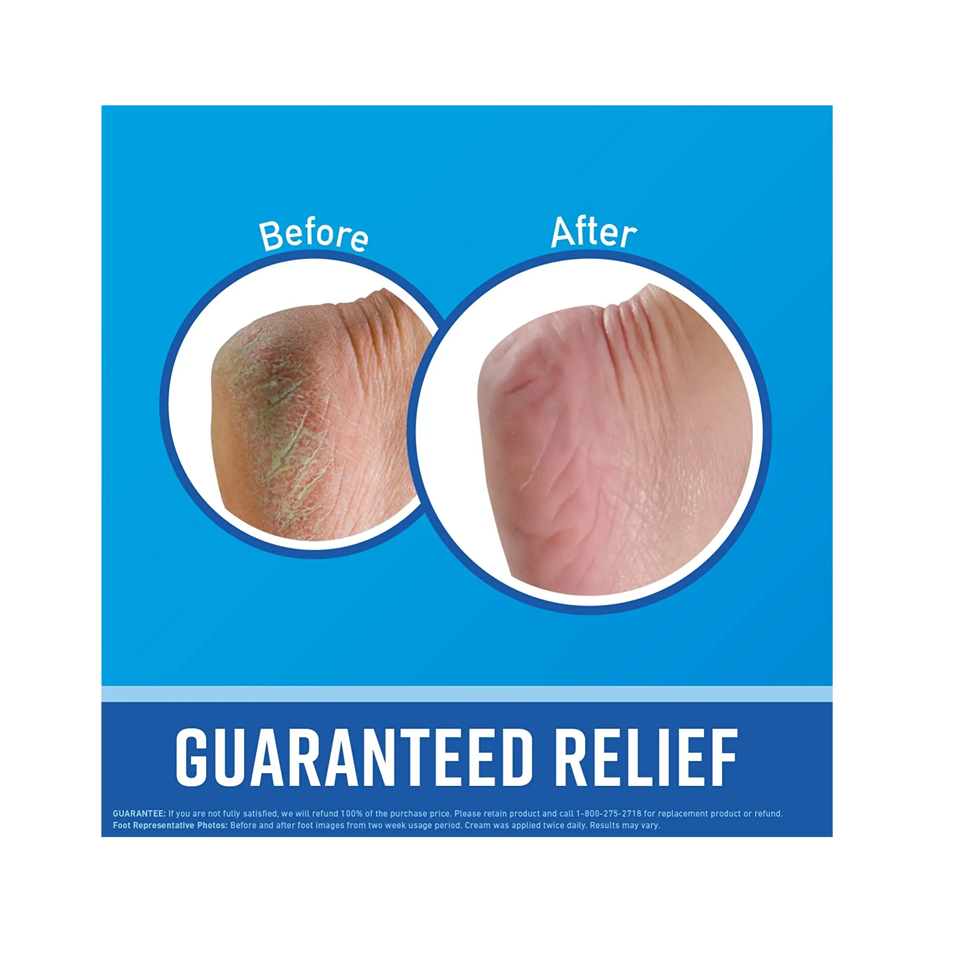 O'Keeffe's for Healthy Feet Foot Cream Guaranteed Relief for Extremely Dry Cracked Feet Instantly Boosts Moisture Levels 3.2 Ounce Jar Pack of 12