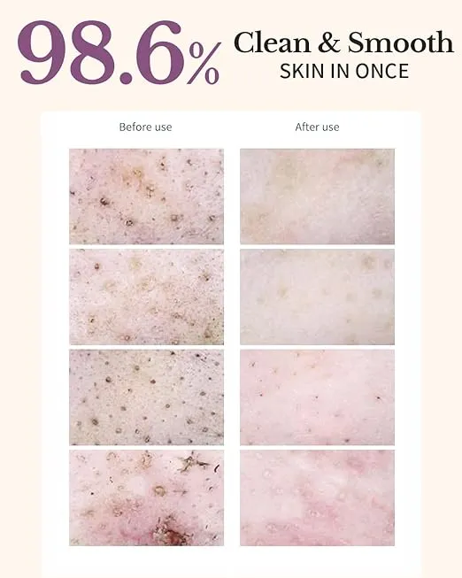 Ongredients Pore Cleansing Pads