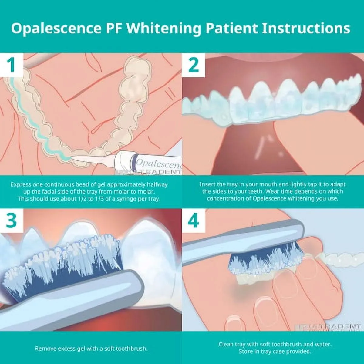 Opalescence Teeth Whitening Gel Syringes 35% Mint - Teeth Whitening, Oral Health - 4 Syringes