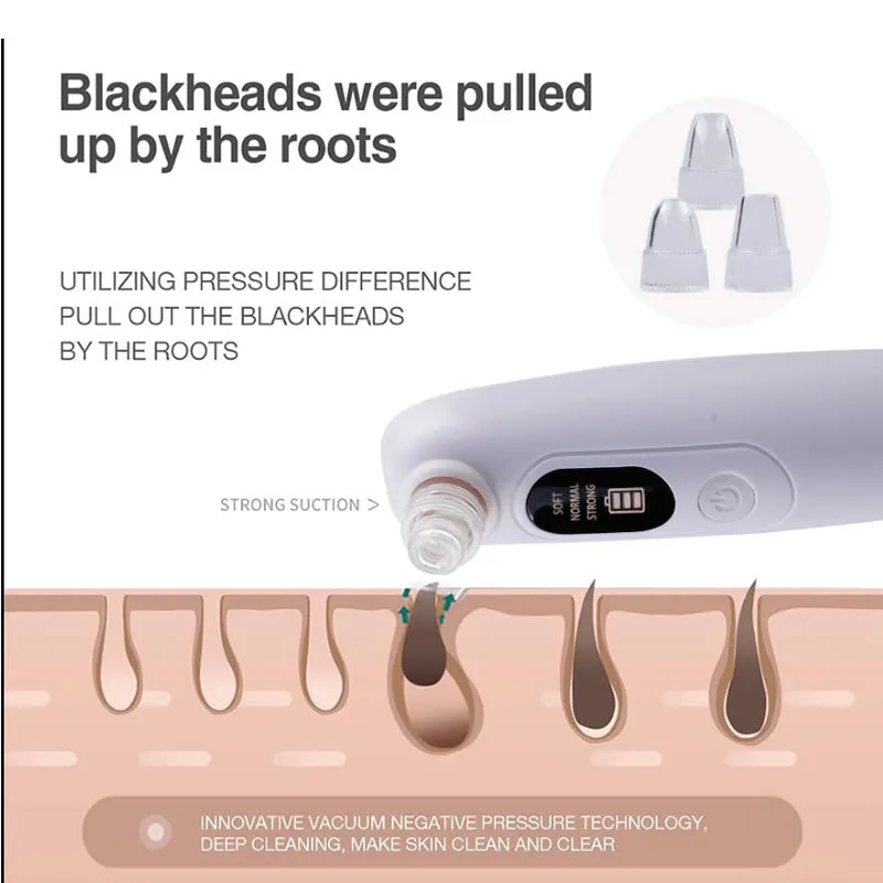 Rechargeable Handheld Blackhead Led Display Remover