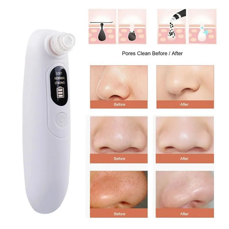 Rechargeable Handheld Blackhead Led Display Remover