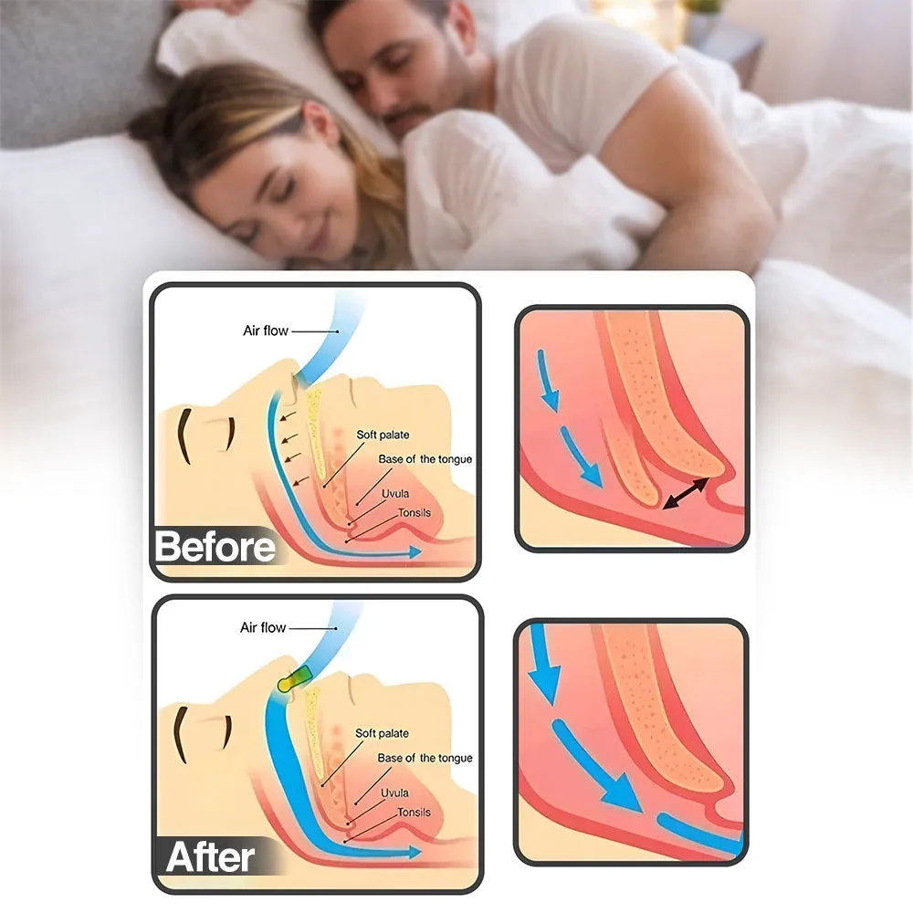 Restful Magnetic Nose Strips