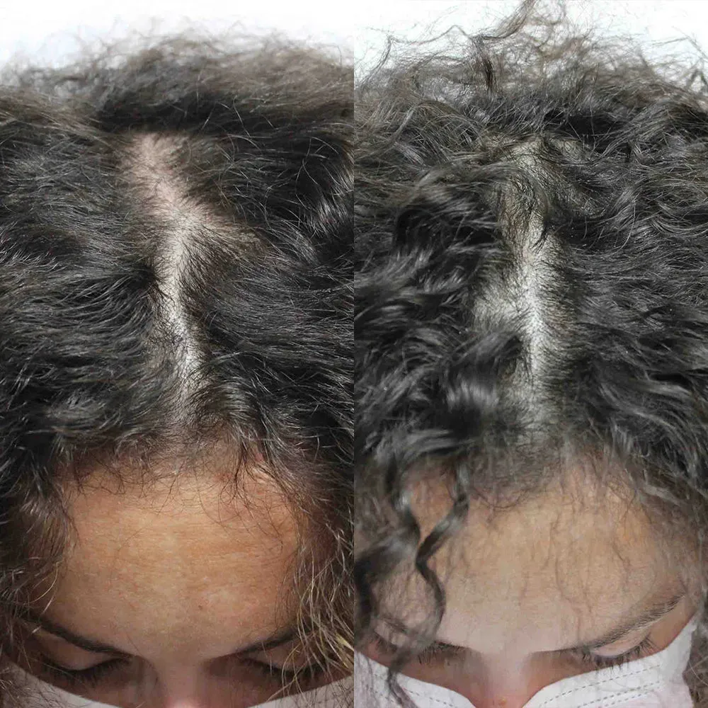 Scandinavian Biolabs hair growth treatment (women)