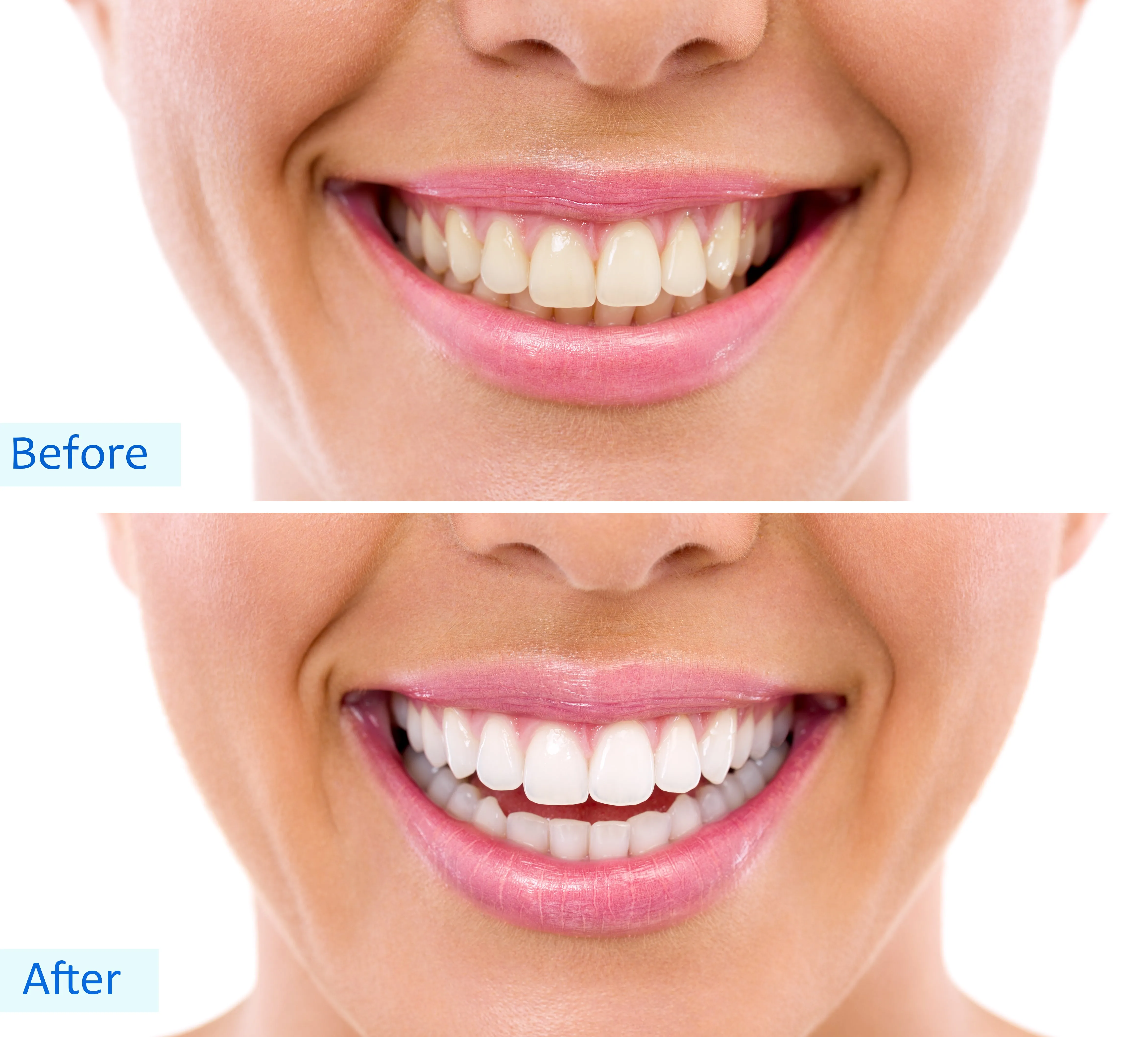 Sexy Sparkles Tooth Whitener, Teeth Whitening Activated Charcoal Powder Natural Organic Whitens Stained Teeth