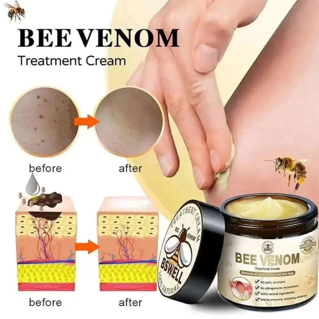 Skin Tag Removal Cream | Bee Venom Skin Treatment Cream 100g