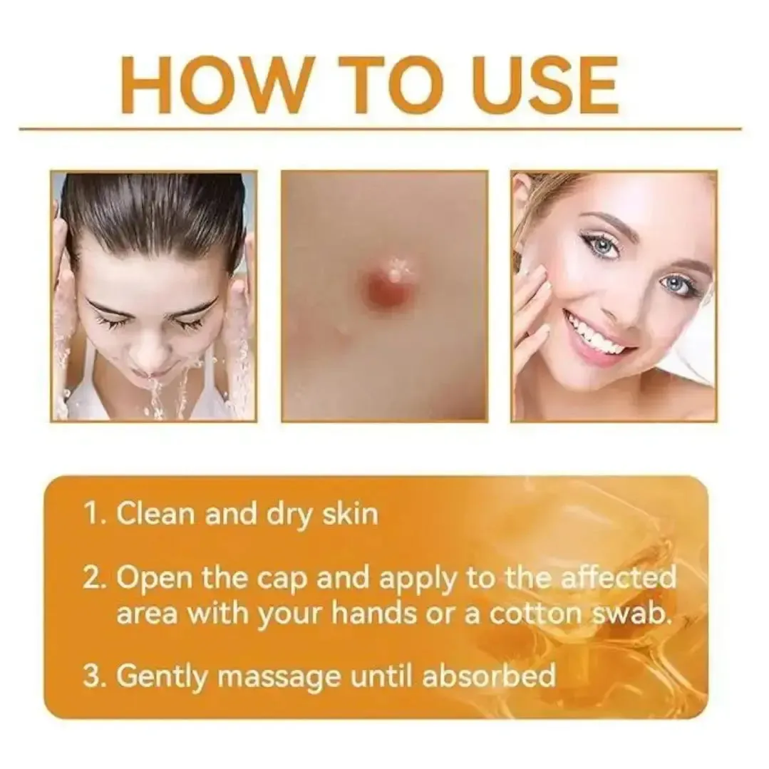 Skin Tag Removal Cream | Bee Venom Skin Treatment Cream 100g