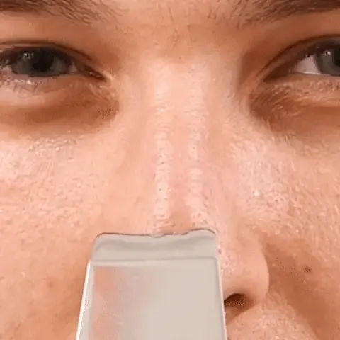 SmartMart® Ultrasonic Facial Skin Scrubber