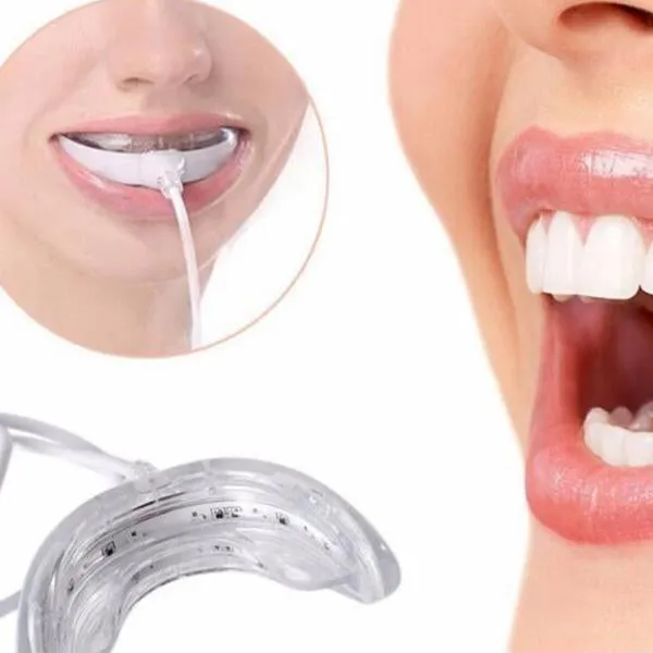 The Best Teeth Whitening Instrument That Plugs Directly to Your Smartphone or Computer via the USB Port
