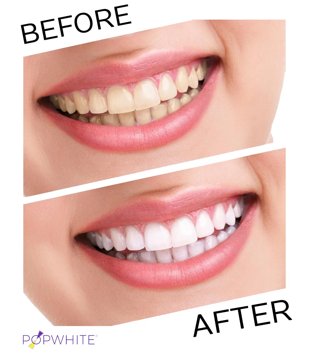 Whitening Toothpaste [4oz]