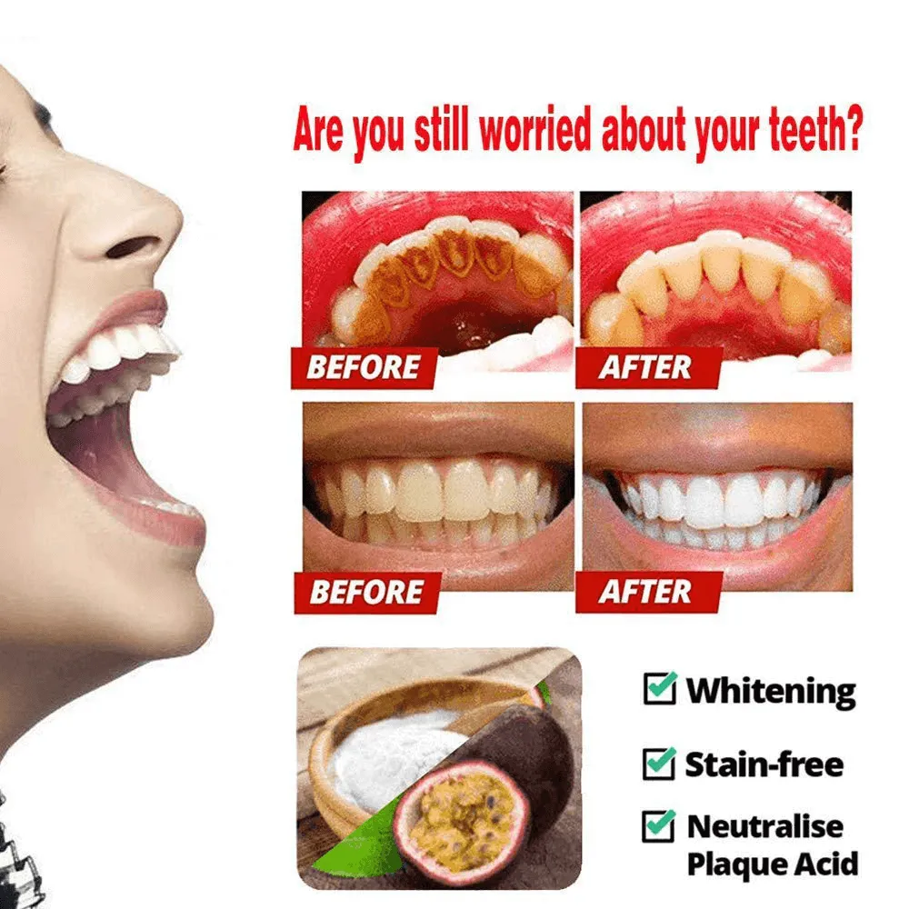 Whitening Toothpaste For Oral Hygiene | Magical Baking Soda Stain Removal