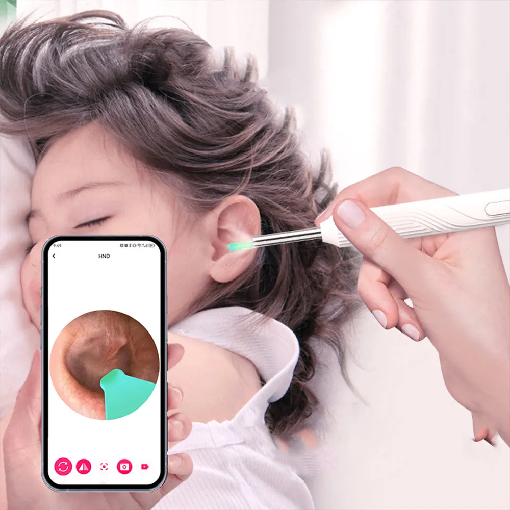 WiFi Wax Removal Tool Camera HD Ear Scope Otoscope with Light White