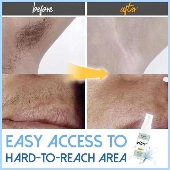 Wonder Hair Removal Spray - Replace Your Shave Cream For Good!